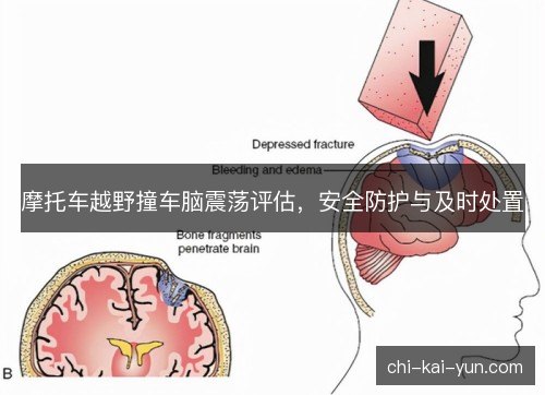 摩托车越野撞车脑震荡评估,安全防护与及时处置 摩托车越野撞车脑震荡评估,安全防护与及时处置
